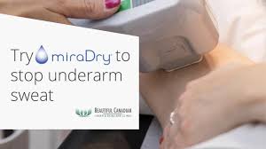1 however, you may be able to use your hsa/fsa funds toward miradry. Vancouver Miradry Treatment In Surrey Kill Underarm Sweat Glands Odour