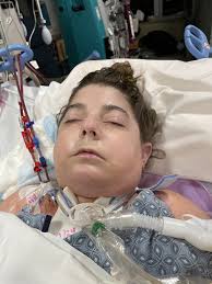 My dad had double lung transplant surgery 6/23. Surgery went well. He has  since been