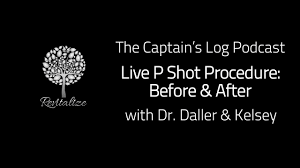 Live P Shot Procedure - Before & After - YouTube