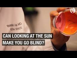 This might take weeks, but it can happen in a matter of days or even few hours.' Can Looking At The Sun During An Eclipse Make You Go Blind Youtube