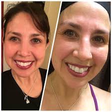 meaning of one sided wear