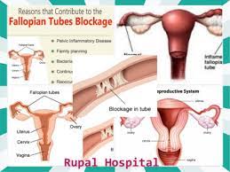We did not find results for: Getting Pregnant With Blocked Fallopian Tubes Independent Newspaper Nigeria
