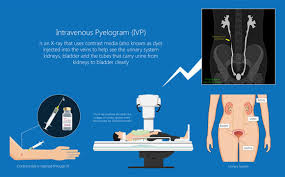 Image result for Intravenous Pyelogram