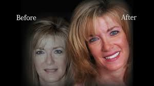 Cosmetic Dentist Plano