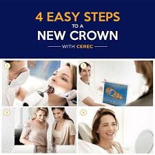 Cerec Same Day Crowns Are Wonderful No Messy Impression Material No Temporary Crowns No Additional App Oral Health Education Dental Dental Care Clinic