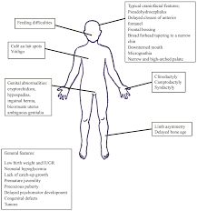 Silver Russell Syndrome A Review Springer Publishing
