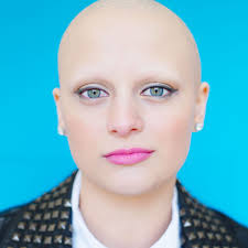 In this disease, white blood cells attack the rapidly growing cells in the hair follicles, which drastically slows down hair production. Haarverlust Bei Frauen Plotzlich Kahl Fotoprojekt Der Spiegel