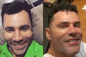 I live in são paulo, brazil and i'm currently a freelance artist in traditional arts and digital painting. Rodrigo Sant Anna Volta A Chamar Atencao Na Web Por Supostos Procedimentos Esteticos Quem Quem News