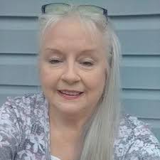 Does anyone know why Becky doesn't wear a wedding ring? I'm just curious.  Edited-Becky has severe eczema