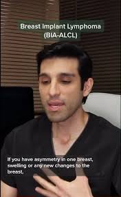 SurgeonSpotlight ✨@DrMichaelOmidi made the 2018 '10 BEST Plastic Surgeons'  in Los Angeles 🌴 ⠀⠀⠀⠀⠀⠀⠀⠀⠀ .⠀⠀⠀⠀⠀⠀⠀⠀⠀ Considering cosmetic or dental work?  Message us 💌 We know the best of the best in the