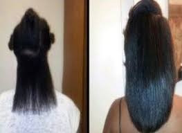 This shampoo prevents hair loss and treats dht buildup as well as dandruff. African American Hair Growth Biotin Natural Remedies Treatments Regimen Vitamins Pills Black Women Hair Growth Natural Hair Styles Relaxed Hair Hair Skin