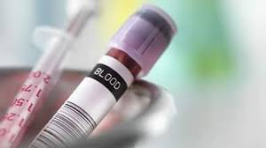 Complete Blood Count C B C R B C صفحة التمريض السوداني فيسبوك
