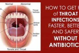 8 Effective Natural Home Remedies To Treat A Strep Throat Infection In 2020 Throat Infection Strep Throat Throat