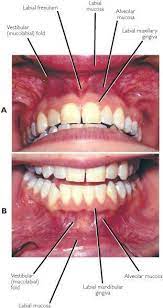 Healthandwellness Healthylifestyle Dentalhygiene Healthylife Healthcare Dentalelle Tutoring Healthden Dental Anatomy Dental Registered Dental Hygienist