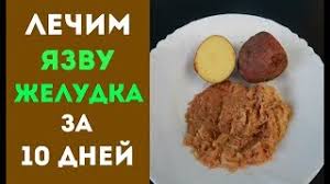 Kak Vylechit Yazvu Zheludka I Gastrit Za 10 Dnej Kartofelem Youtube