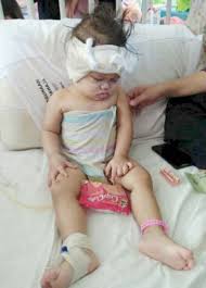 5277 ziyaretçi hospital sultanah nora ismail ziyaretçisinden 37 tavsiye gör. Batu Pahat Toddler Severely Injured In Dog Attack