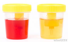 Check spelling or type a new query. 11 Warna Urine Ini Penanda Kesehatan Anda Nomor 7 Waspadai Sibolgapos