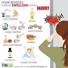 Home Remedies For Swelling On The Head From An Injury Goose Egg Top 10 Home Remedies Top 10 Home Remedies Swelling Remedies Home Remedies