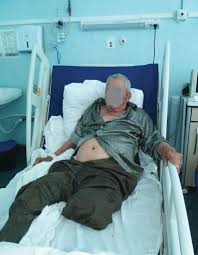 Da, asa e cu organele. Octogenar NevÄzÄtor Cu Piciorul TÄiat Pus Pe Lista De AÈteptare A Cjas Gorj Pentru Un Scaun Cu Rotile Stiri Locale De Ultima Ora Stiri Video Stiri Gorjeanul Ro