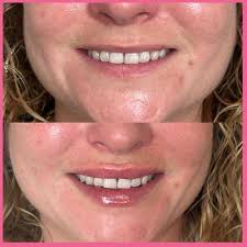 Modern Skin Solutions CT, 495 Gold Star Hwy, Ste 200, Groton, CT 06340, US 