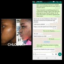 Chloe Kay Luxury DAY and NIGHT FACE CREAM- Combo 70ml Each Free Shipping