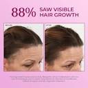 Women's Hair Regrowth Treatment with Minoxidil - BosleyMD | Ulta ...