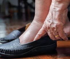 You may suffer from swelling in the pelvic area and legs. Leg Swelling In Aging What To Know What To Do Better Health While Aging
