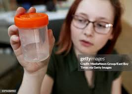 11 Child Kidney Stone Stock Photos, High-Res Pictures, and Images