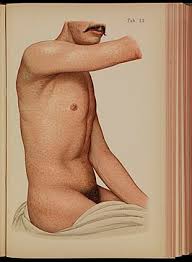 Maybe you would like to learn more about one of these? Syfilis Wikipedia