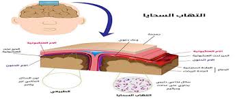 Meningitis b is an uncommon but potentially fatal disease. Ø§Ù„ØªÙ‡Ø§Ø¨ Ø§Ù„Ø³Ø­Ø§ÙŠØ§ Ù…Ø±Ø¶ Ø§Ù„Ø³Ø­Ø§ÙŠØ§ Ø§Ø¹Ø±Ø§Ø¶ Ø§Ù„Ø³Ø­Ø§ÙŠØ§ ÙˆÙŠØ¨ Ø·Ø¨