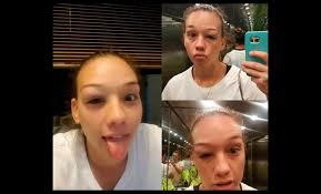 Claudia christiane endler mutinelli (nacida el 23 de julio de 1991) es una futbolista profesional chilena que juega como. Asi Fue El Feroz Rodillazo Que Recibio Puranoticia