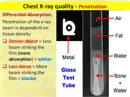 Pin By Ros Sambor On Radiology Tech In 2020 X Ray Concept Map Nursing Fundamental
