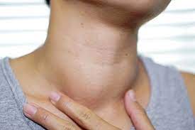 You might feel like food is stuck in your throat. Head And Neck Cancer Of Unknown Primary Site Johns Hopkins Medicine