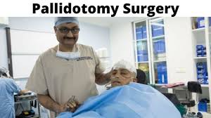 Image result for Pallidotomy