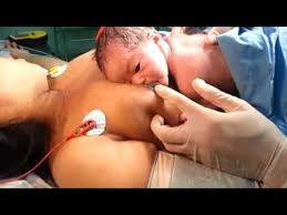Image result for inisiasi menyusui dini