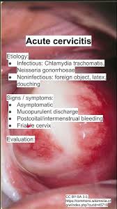 Image result for Friable Cervix
