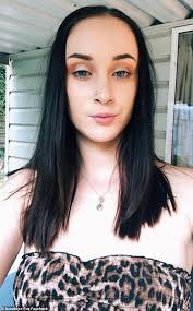 Chemical burns can be minor and sever. Woman Suffers Shocking Chemical Burns From Diy Hair Bleaching Express Digest