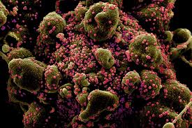All of your questions, answered. F D A Approves First Coronavirus Antibody Test In U S The New York Times