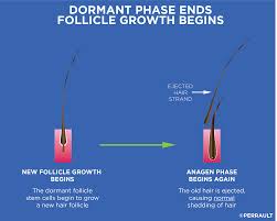 Hairs are shed from their resting follicles at this time. Hair Growth Cycle Gl Perrault Md Hair Loss And Hair Restoration