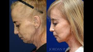 Chris Barsh, ARNP, FNP-BC