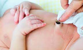 Nabelpflege Beim Baby Kindergesundheit Info De