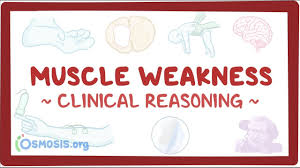 Image result for Muscle Weakness