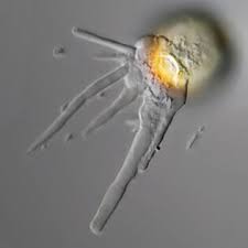 Image result for Raphidiocystis