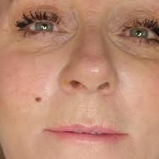 Beauty marks, birthmarks and moles. Freckles Tattoos And Beauty Marks Goddess Permanent Makeup