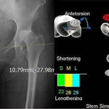 Image result for Shuck Test
