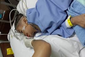 Hasil gambar untuk meningitis disebabkan oleh