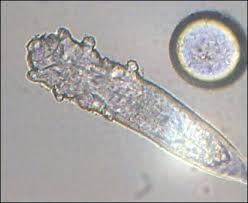 Image result for Demodex folliculorum