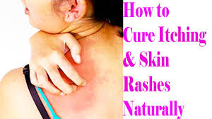 While at other times, diseases like eczema, allergies, psoriasis, flea or insect bites tips to get rid of skin rashes naturally. 3 Most Effective And Easy Home Remedies For Itchy Skin How To Cure Itching Skin Rashes Naturally Natural Remedies