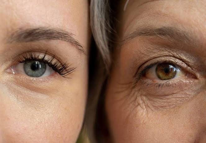 Sunekos Performa: How It Works To Improve Common Under-eye Concerns - The Bloom Clinic