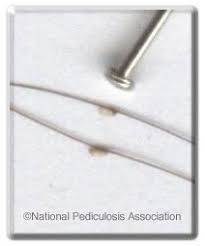In the old days it was called nit picking or lice picking and people would pick lice out of hair. What Are Head Lice And Nits Headlice Org